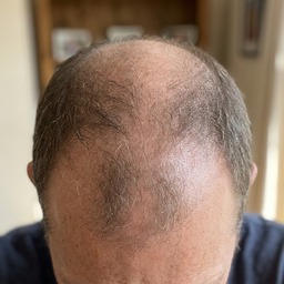 Mike R. crown, day 1